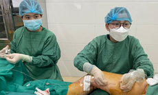 Câu hỏi thường gặp liên quan đến bệnh suy tĩnh mạch chân