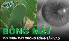 Nhiều bệnh nhân bỏng kết giác mạc do nhựa cây xương rồng bắn vào mắt