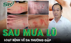 Loạt bệnh về da thường gặp sau mùa mưa lũ cần đặc biệt lưu ý
