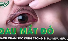 Xử trí đau mắt đỏ trong mùa mưa lũ thế nào?