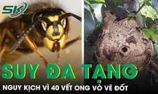 Người đàn ông bị ong vò vẽ đốt 40 vết nguy kịch suy đa tạng