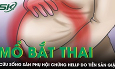 Mổ bắt thai cứu sản phụ hội chứng HELLP tiền sản giật nặng