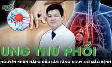 Yếu tố nguy cơ nào dẫn đến bệnh ung thư phổi?