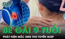 Bé gái 9 tuổi xuất hiện u ở cổ, đi khám phát hiện mắc ung thư tuyến giáp