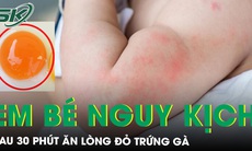 Bệnh nhi 6 tháng tuổi nguy kịch sau khi ăn lòng đỏ trứng gà được 30 phút