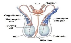 Thuốc và các phương pháp điều trị giãn tĩnh mạch thừng tinh