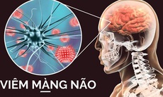 Những câu hỏi liên quan bệnh viêm màng não mủ