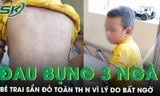 Bé trai 8 tuổi sẩn đỏ toàn thân, đau bụng vùng quanh rốn suốt 3 ngày vì lý do bất ngờ 