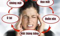 Rối loạn tiền đình ở người trẻ phải làm gì?