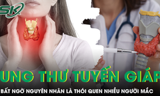 Bất ngờ thói quen nhiều người Việt mắc phải là nguyên nhân gây ung thư tuyến giáp