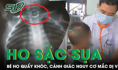 Trẻ ho sặc sụa, quấy khóc, đừng chủ quan với nguy cơ mắc dị vật