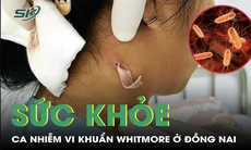 Cập nhật mới về ca nhiễm vi khuẩn Whitmore ở Đồng Nai 