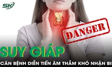 Dấu hiệu âm thầm khó nhận biết của bệnh suy giáp