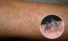 Những điều cần biết khi chăm sóc người bệnh sốt xuất huyết