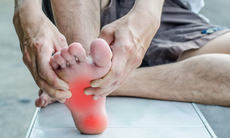 Viêm cân gan chân: Nguyên nhân, triệu chứng, phòng bệnh và cách điều trị