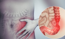 Dấu hiệu nhận biết bệnh viêm ruột