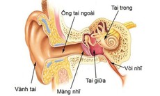 Viêm tai giữa: Nguyên nhân, triệu chứng, cách điều trị và phòng bệnh