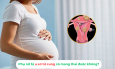 Phụ nữ bị u xơ tử cung có mang thai được không?