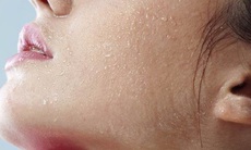 Thói quen xấu khiến da khô bong tróc trong mùa đông