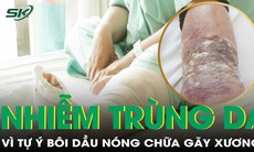 Người đàn ông nhiễm trùng da vì bôi dầu nóng chữa gãy xương