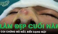 Cảnh báo xu hướng làm đẹp cuối năm, coi chừng mù mắt, biến dạng mặt