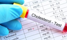 4 cách kiểm soát cholesterol máu để phòng ngừa bệnh tim mạch