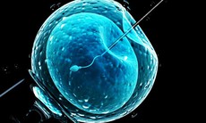 Sử dụng AI có thể giúp tăng tỷ lệ thành công của IVF