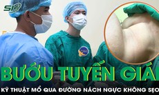 Mổ bướu tuyến giáp không sẹo cổ qua đường nách ngực