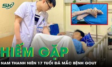 Học sinh 17 tuổi đã mắc bệnh Gout mạn
