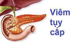 Vì sao uống nhiều bia rượu gây viêm tụy cấp?