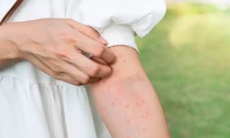 Dị ứng thức ăn ngày Tết cần biết để tránh rủi ro