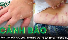 Tăng cân đột ngột, mặt tròn đỏ cảnh báo suy tuyến thượng thận