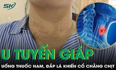 Cổ chằng chịt sẹo, sức khỏe suy kiệt sau khi đắp lá chữa u tuyến giáp