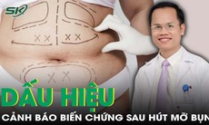 Có những dấu hiệu này sau hút mỡ cần thăm khám ngay