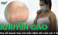 Thai phụ khi mắc bệnh sởi cần lưu ý gì?