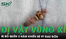 Bé gái 9 tuổi đau đớn vì dị vật để quên 3 năm trong âm đạo 