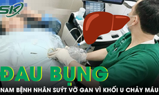 Đau bụng tưởng nhẹ, người đàn ông suýt vỡ gan vì khối u chảy máu