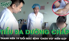 Kỳ tích cứu nam thanh niên đi tiểu ra dưỡng chấp như sữa do bệnh ‘chân voi’ hiếm gặp 