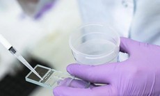 3 chiến lược bảo tồn khả năng sinh sản cho người nhiễm HIV