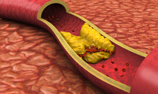 4 loại đồ uống giúp ‘làm sạch’ mạch máu, ngăn ngừa mảng bám và bảo vệ tim mạch