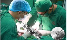 Bác sĩ cứu sống bàn tay bị vỡ nát cho bệnh nhân sau tai nạn giao thông