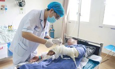 Bỏng nặng vì đốt rác bằng xăng