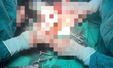 Cứu sống bệnh nhân chửa ngòai tử cung vỡ tại Trung tâm Y tế Bạch Long Vĩ