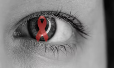 Những bệnh lý tại mắt thường gặp ở người sống chung với HIV