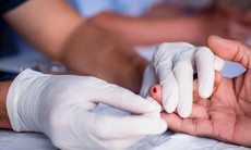 Xét nghiệm HIV có được bảo mật không?