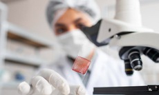 Liệu có thể chữa ung thư bằng cách điều chỉnh vi sinh trong mô u?