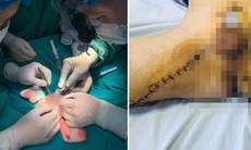 Nối dương vật thành công cho bệnh nhi ở Hải Phòng