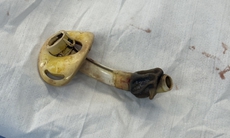 Người phụ nữ tìm lại hơi thở tự nhiên sau 7 năm sống cùng ống nội khí quản