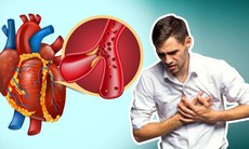 Người bệnh tim mạch cần lưu ý gì trong mùa lạnh?