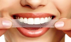 Rủi ro khi lạm dụng miếng dán trắng răng